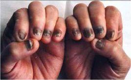 角形甲弧影 角形甲弧影