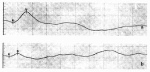 適應反應 適應反應