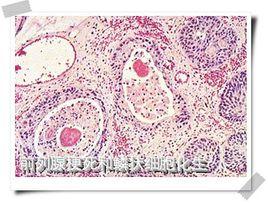 化生細胞 化生細胞