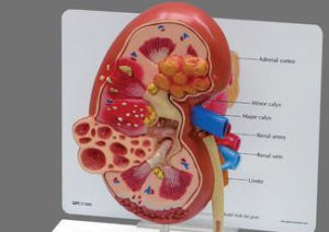 腎性水腫 腎性水腫