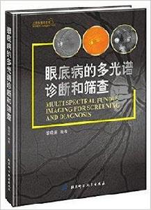 眼底病的多光譜診斷和篩查