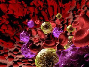 繼發於嚴重肝疾患的棘紅細胞增多症
