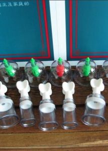 真空拔火罐 真空拔火罐