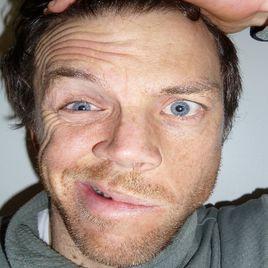 面部神經麻痹 面部神經麻痹