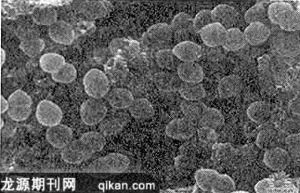 艾森曼格綜合症