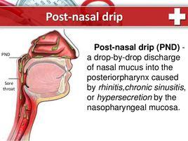 鼻後滴漏綜合症 鼻後滴漏綜合症