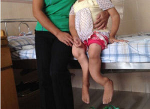 范科尼綜合徵 范科尼綜合徵