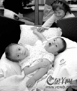 染色體異常伴發的精神障礙