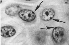 （圖）表觀遺傳學