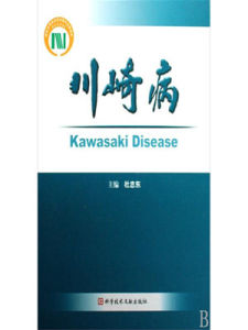 川崎病 川崎病