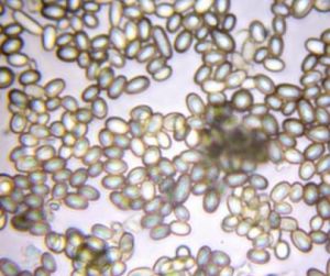 黴菌孢子 黴菌孢子