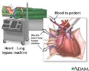 椎基底動脈供血不足