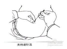 針灸手法之進法 針灸手法之進法
