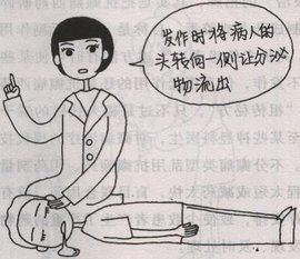 癲癇大發作 癲癇大發作