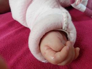 寶寶拇指內扣 寶寶拇指內扣