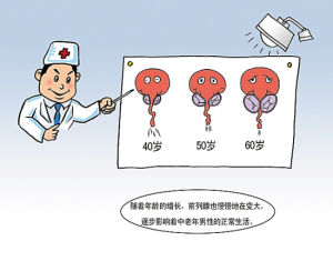 圖說良性前列腺增生