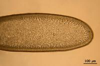 矮小擬伊藻的藻體切面