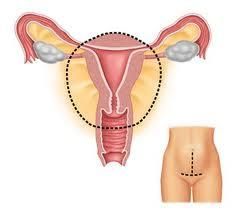 閉經的症狀 閉經的症狀