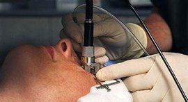 近視眼矯正手術 近視眼矯正手術