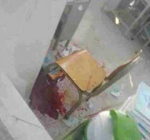 座位上面流出的受傷女生血跡