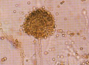 黃麴黴毒素M1 黃麴黴毒素M1