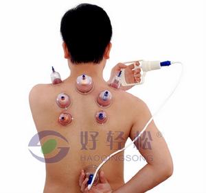 真空拔火罐療法