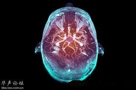 人腦處理信息意識論