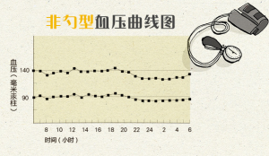 非勺型血壓