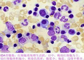 核老漿幼 核老漿幼