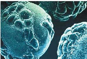 高滲性非酮症糖尿病昏迷