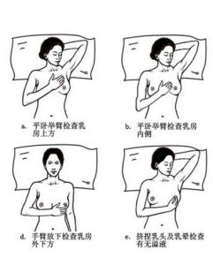 乳房自檢 乳房自檢