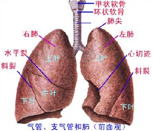 喉氣管瘢痕性狹窄