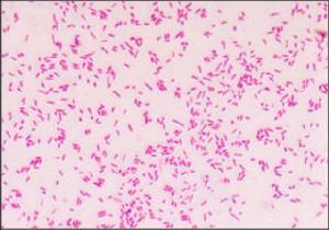 （圖）腸病原的大腸埃希桿菌感染