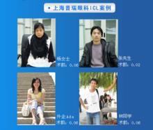 近視雷射矯正術