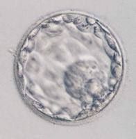 囊胚培養 囊胚培養