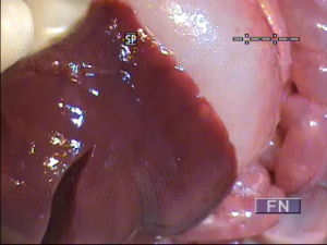 病變的內臟組織