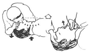 人工呼吸急救方法