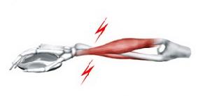 長時間的不正確姿勢