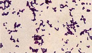 化膿性鏈球菌