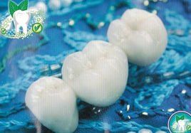 全瓷烤瓷牙 全瓷烤瓷牙