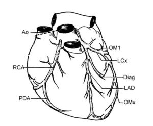 無症狀型冠心病 無症狀型冠心病