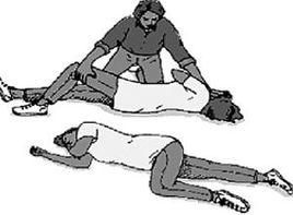 癲癇的複雜部分性發作 癲癇的複雜部分性發作