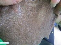 純肌泉海藻面膜