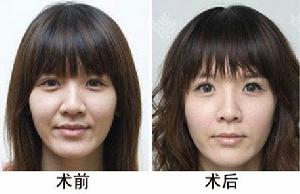 張冰潔[整形醫生]