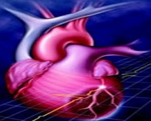 老年人多器官功能衰竭