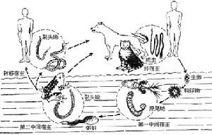 電擊傷所致脊髓病 電擊傷所致脊髓病