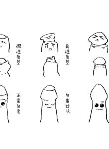 隱匿陰莖 隱匿陰莖