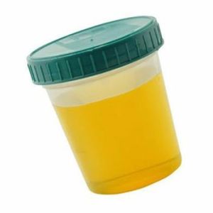 血清尿酸 血清尿酸