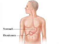 胃癌基因 胃癌基因