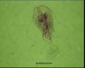 藍氏賈第鞭毛蟲